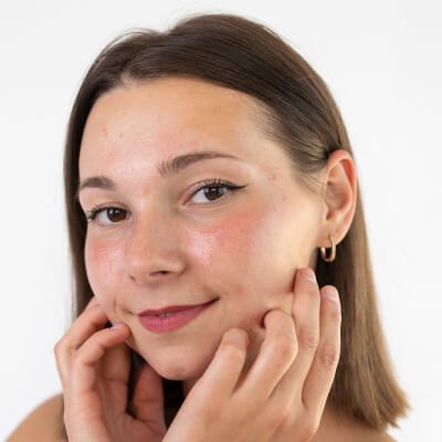 before-after-facials-3-a before-after-facials-3-a